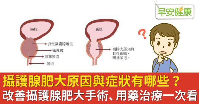 攝護腺肥大的患者不建議一次服用兩顆犀利士5mg，避免引起副作用